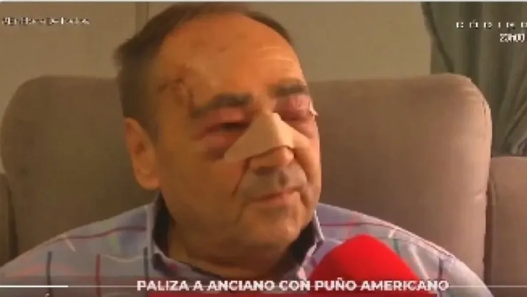 Anciano agredido Lorca